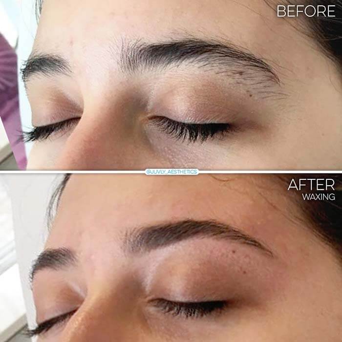 before-after-waxing