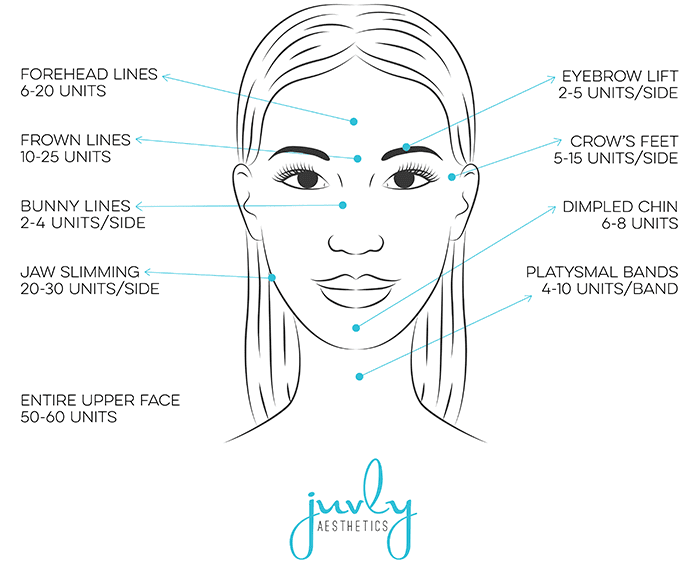 botox-face-areas