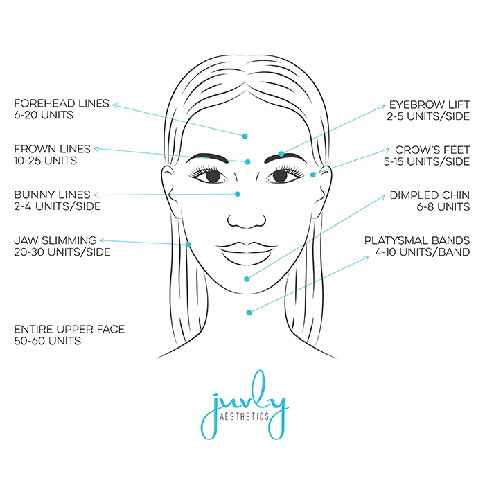 botox-face-diagram
