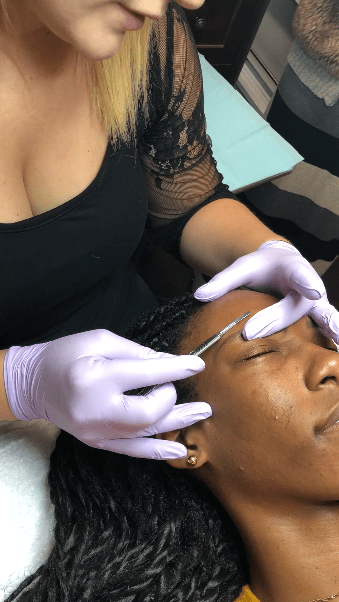 dermaplane-woman-results-min