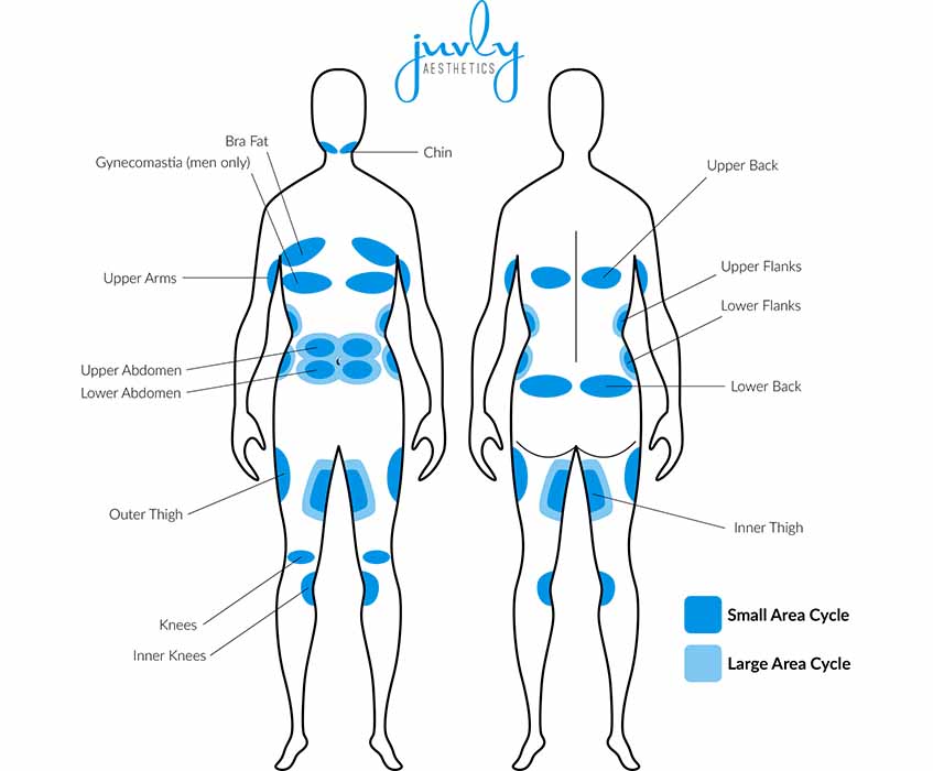 Coolsculpting-diet-exercise-fat-chart