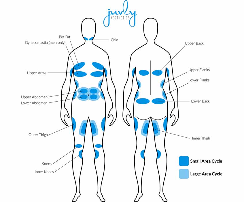 Coolsculpting-diet-exercise-fat-chart Coolsculpting-diet-exercise-fat-chart