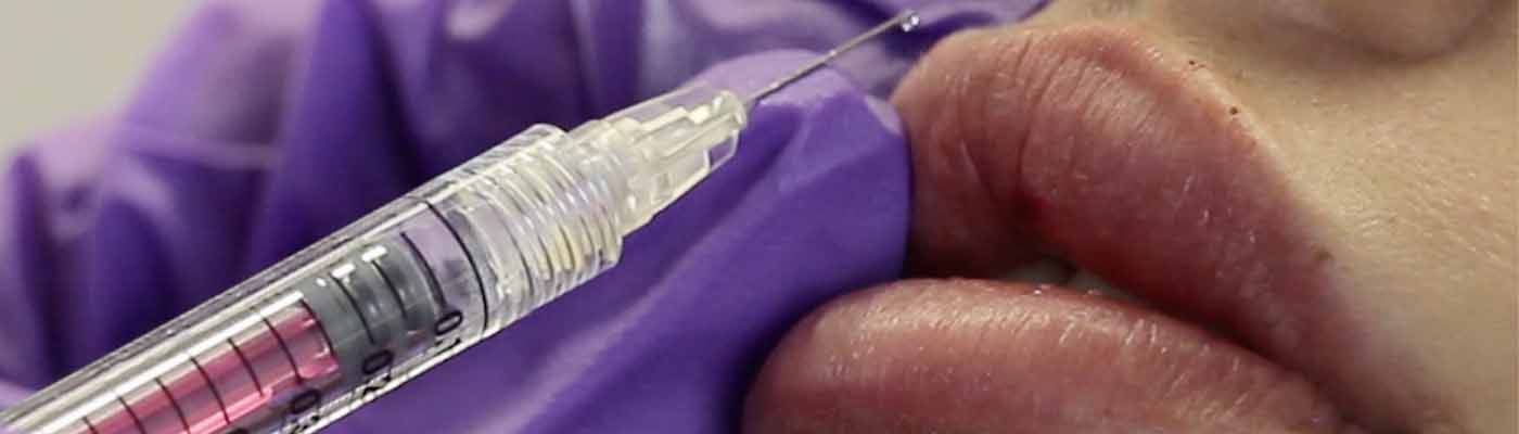 causes-of-lip-damage-featured