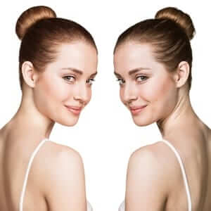 chemical-peel-no-downtime chemical-peel-no-downtime