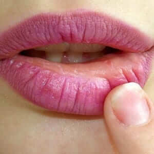 dehydrated-lips dehydrated-lips