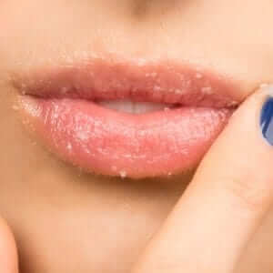 vitamin-mineral-deficiency-lips