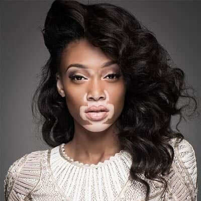 winnie-harlow-lips winnie-harlow-lips