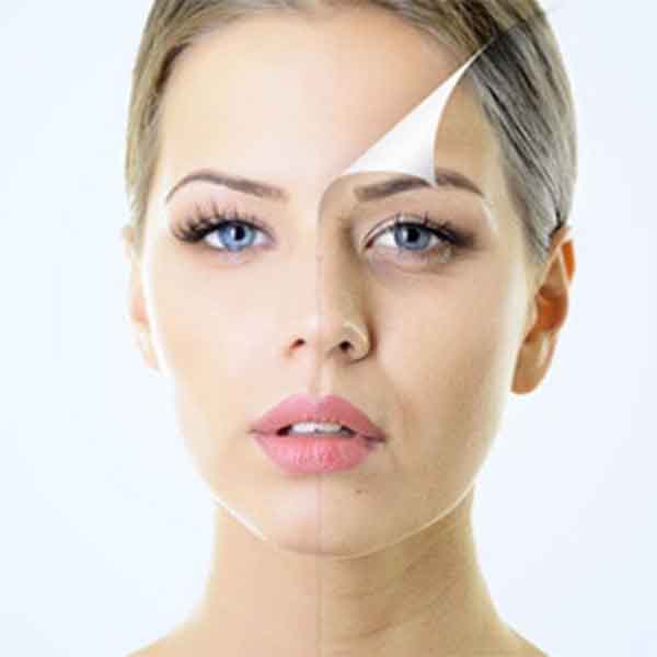 hyperpigmentation-causes-fixes