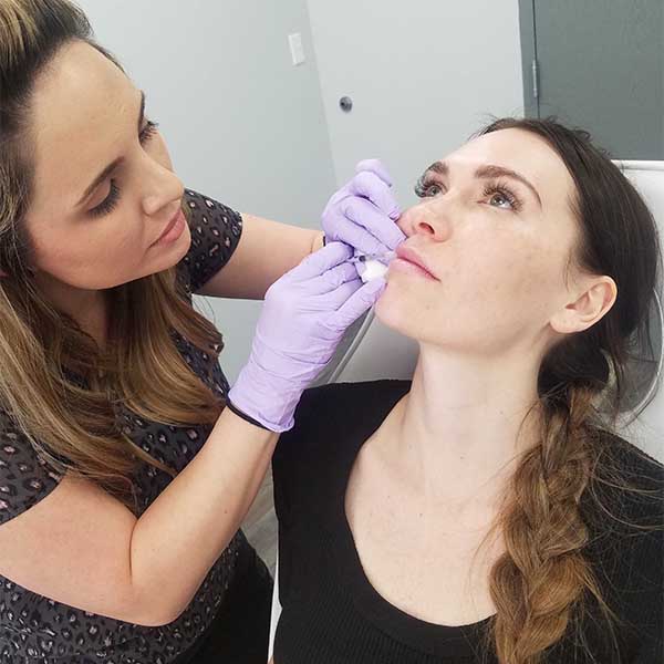 lip-filler-aftercare-injections