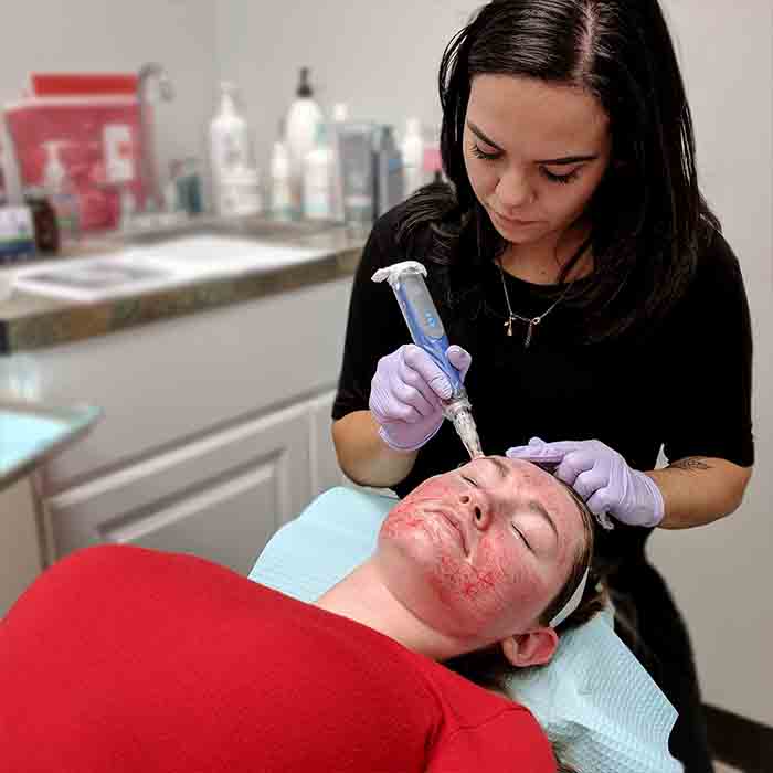 popular-microneedling-myths-busted-woman (1) popular-microneedling-myths-busted-woman (1)