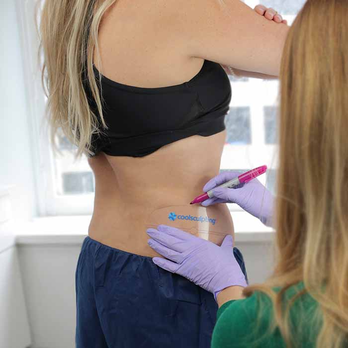 the-7-most-popular-areas-of-the-boday-for-coolsculpting-side