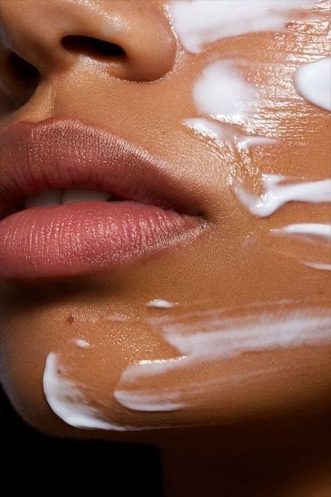 acne3 acne3
