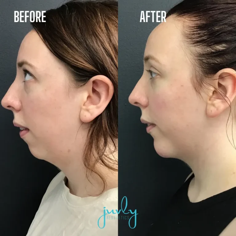 BnA template (Instagram Post (Square)) (15)