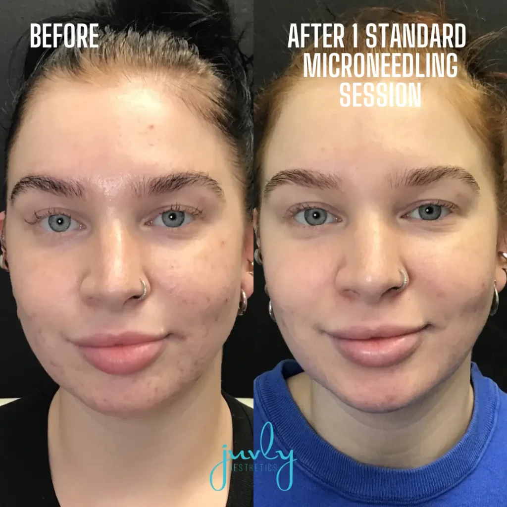 BnA template (Instagram Post (Square)) (16)