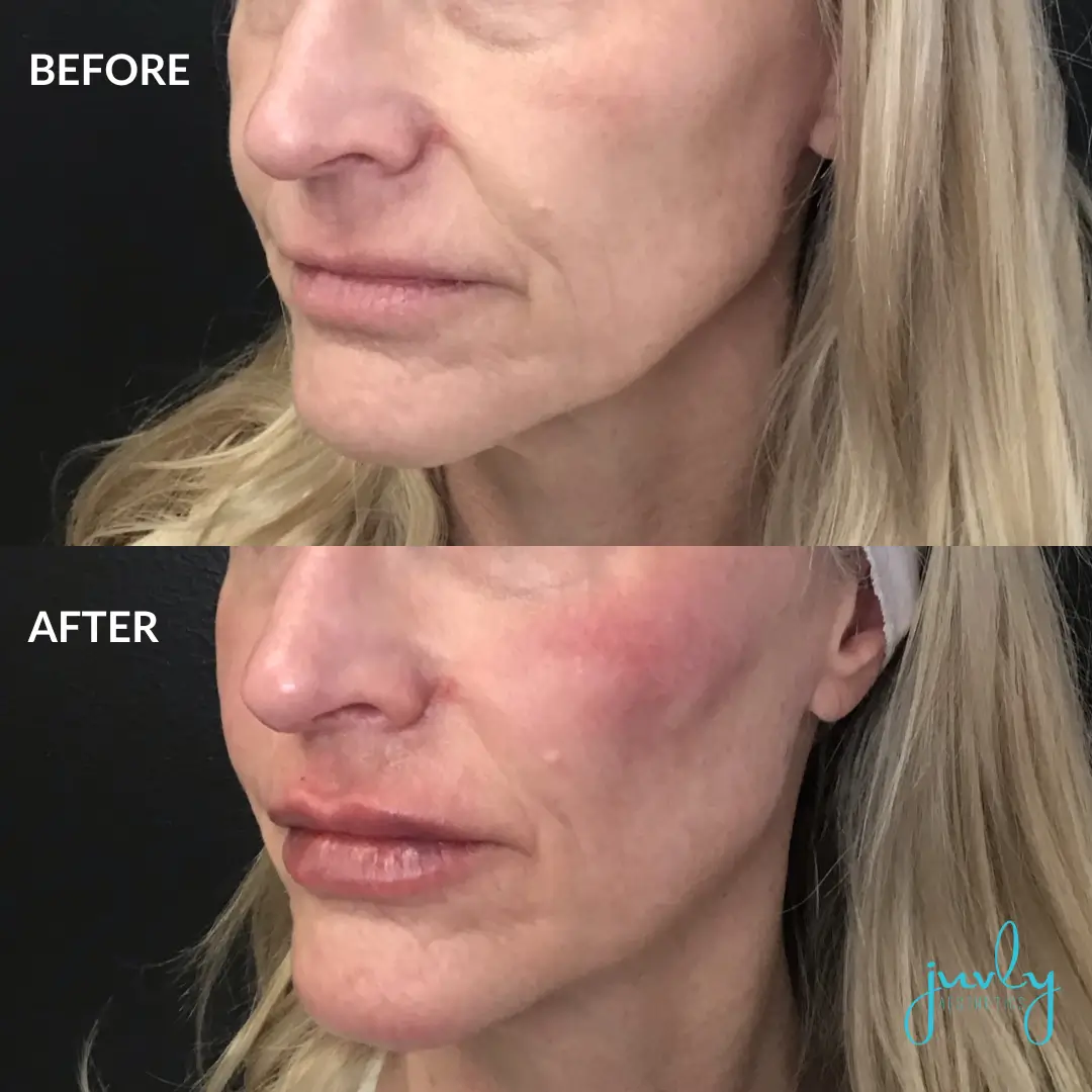 BNA Instagram Post Size Template (3)