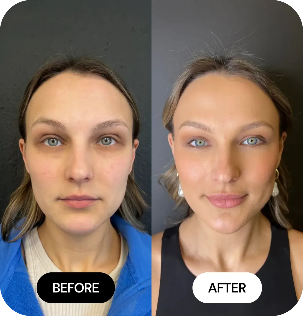 JLYFT before and after