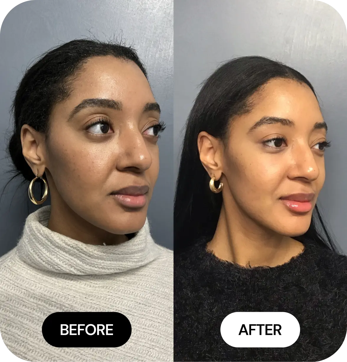 JLYFT before and after